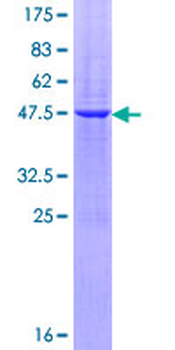 PAEP (Human) Recombinant Protein (P01)
