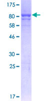 P4HB (Human) Recombinant Protein (P01)