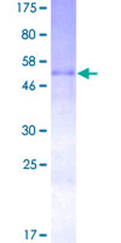 OSM (Human) Recombinant Protein (P01)
