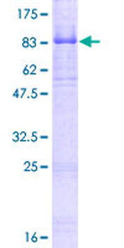 NTRK2 (Human) Recombinant Protein (P01)