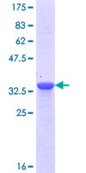 NPHS1 (Human) Recombinant Protein (Q01)