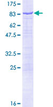 NMT1 (Human) Recombinant Protein (P01)