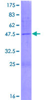 NME4 (Human) Recombinant Protein (P01)