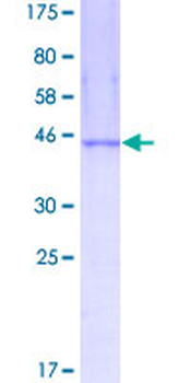 NME3 (Human) Recombinant Protein (P01)