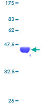 NME2 (Human) Recombinant Protein (P01)