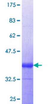 NINJ1 (Human) Recombinant Protein (Q01)