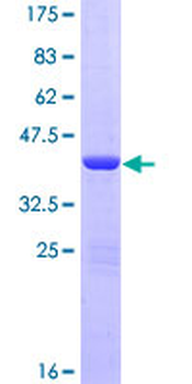 NHP2L1 (Human) Recombinant Protein (P01)
