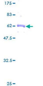 NFKBIA (Human) Recombinant Protein (P01)