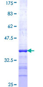 NEU2 (Human) Recombinant Protein (Q01)