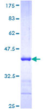 NEFH (Human) Recombinant Protein (Q01)
