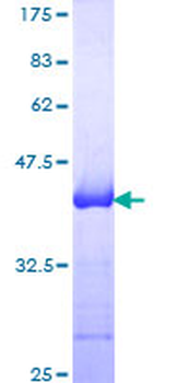 NCAM1 (Human) Recombinant Protein (Q01)