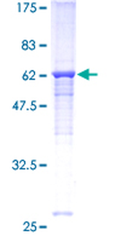 CEACAM6 (Human) Recombinant Protein (P01)