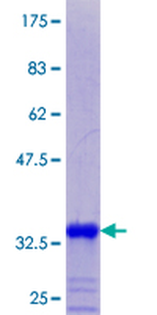 MT2A (Human) Recombinant Protein (P01)