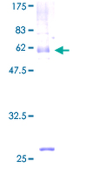 MOG (Human) Recombinant Protein (P01)