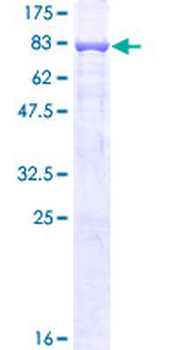 MMP3 (Human) Recombinant Protein (P01)
