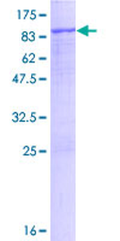 MMP2 (Human) Recombinant Protein (P01)