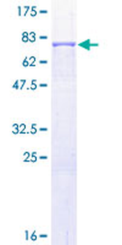 MMP1 (Human) Recombinant Protein (P01)