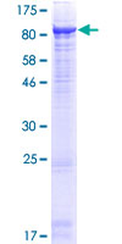 MME (Human) Recombinant Protein (P01)