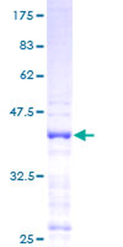 CXCL9 (Human) Recombinant Protein (P01)