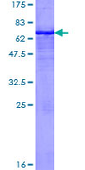 MICA (Human) Recombinant Protein (P01)