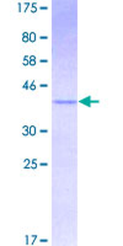 MGST2 (Human) Recombinant Protein (P01)