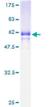 MFI2 (Human) Recombinant Protein (P01)