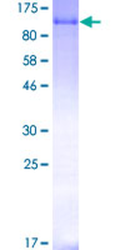 MDM2 (Human) Recombinant Protein (P01)