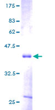 MDK (Human) Recombinant Protein (P01)
