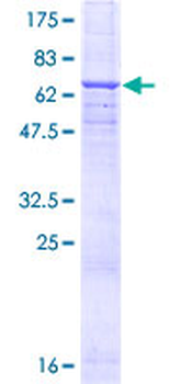 CD46 (Human) Recombinant Protein (P01)