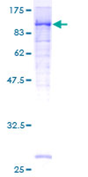 MCAM (Human) Recombinant Protein (P01)