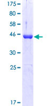 MAX (Human) Recombinant Protein (P01)