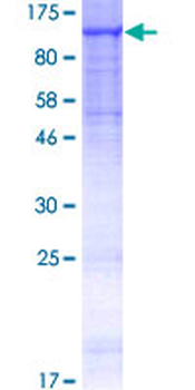 MANBA (Human) Recombinant Protein (P01)