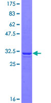 MAGEA1 (Human) Recombinant Protein (Q01)