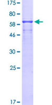 MAGEA1 (Human) Recombinant Protein (P02)