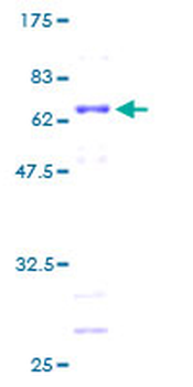 MAGEA1 (Human) Recombinant Protein (P01)