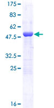 MAD2L1 (Human) Recombinant Protein (P01)