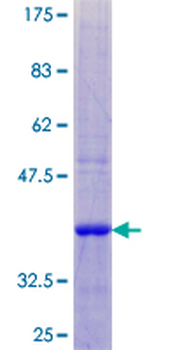 LY6E (Human) Recombinant Protein (P01)