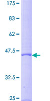 LTA (Human) Recombinant Protein (P02)