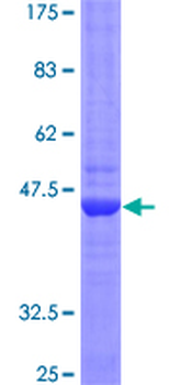 LTA (Human) Recombinant Protein (P01)