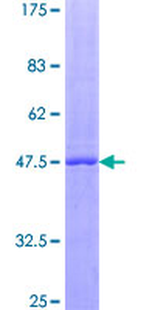 LIF (Human) Recombinant Protein (P01)