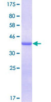 LGALS1 (Human) Recombinant Protein (P01)