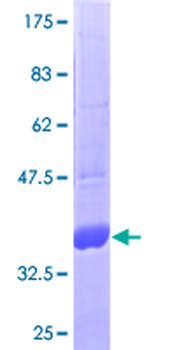 LEP (Human) Recombinant Protein (P01)