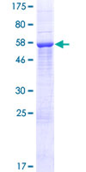 LDHA (Human) Recombinant Protein (P01)