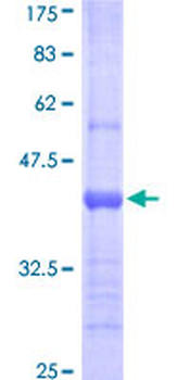 LCN1 (Human) Recombinant Protein (Q01)