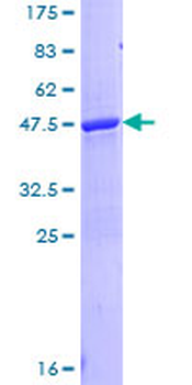 LCN1 (Human) Recombinant Protein (P01)