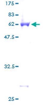 LASP1 (Human) Recombinant Protein (P01)