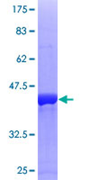 STMN1 (Human) Recombinant Protein (P01)