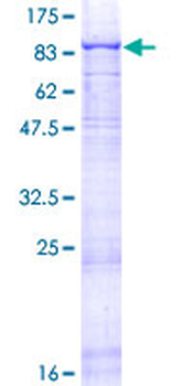 LAMA5 (Human) Recombinant Protein (P01)