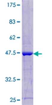LAIR2 (Human) Recombinant Protein (P01)