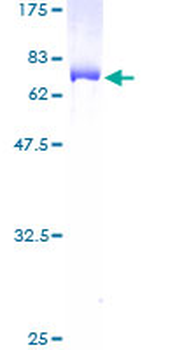 KRT18 (Human) Recombinant Protein (P02)